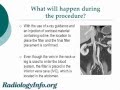 Your Radiologist Explains: Inferior Vena Cava (IVC) Filter Placement and Removal