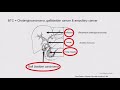 2018 Cholangiocarcinoma Foundation Annual Conference #3 - Day 3 - Adjuvant Therapy