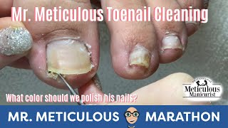 Satisfying Impacted Toenail Cleaning #MrMeticulousMarathon