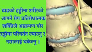 कसैको ढाड दुख्ने समस्या किन कहिल्यै पूर्ण निको हुँदैन?Why someone's back pain never completely cured