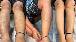 Very very Heavy hair growth leg waxing/Best waxing tips for beginners/ #beauty #legwaxing #waxing