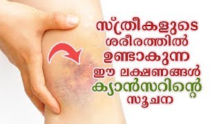 സ്ത്രീകളുടെ ശരീരത്തില്‍ ഉണ്ടാകുന്ന ഈ ലക്ഷണങ്ങള്‍ ക്യാന്‍സറിന്റെ സൂചന