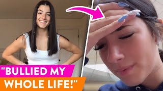 What Nobody Understands About Charli D Amelio Ossa