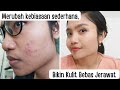 PENYEBAB JERAWAT SULIT HILANG DAN SOLUSINYA | dr.Emasuperr