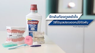 คนไข้จัดฟันต้องใช้ชุดแปรงดูแลฟันยังไง??