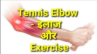 Tennis Elbow- Treatment (इलाज) & Exercise/stretches/physiotherapy.