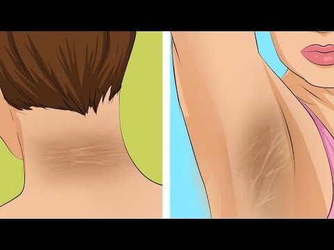 Do Not Ignore These 10 Early Symptoms of Diabetes Do Not Ignore These 10 Early Symptoms of Diabetes