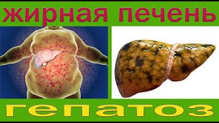 Жирная печень. Как лечить жировой гепатоз.