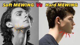 Soft MEWING Vs Hard MEWING | Correct Way For Sharp Jawline