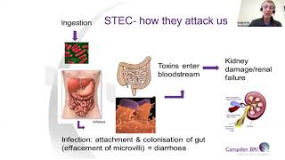STEC (Shiga toxin-producing Escherichia coli) in food