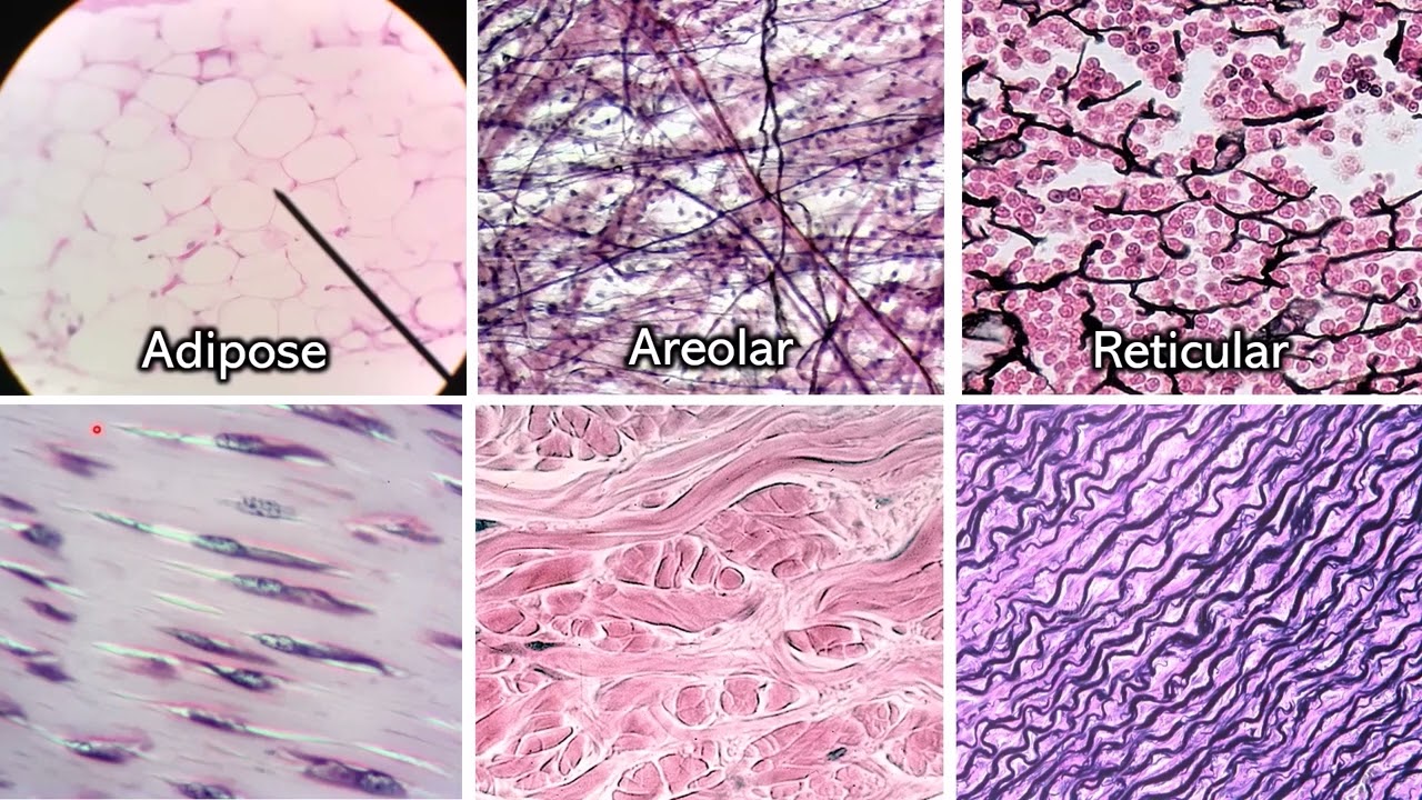 Dense Irregular Connective Tissue Under Microscope A Visual Guide