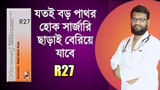 যতই বড় পাথর হোক সার্জারি ছাড়াই বেরিয়ে যাবে | R27 homeopathy medicine