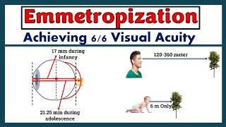 Emmetropization - The process of Achieving normal (6/6) Visual Acuity.