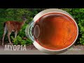 myopia nearsightedness explained hd