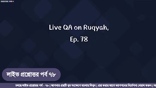 রুকইয়াহ বিষয়ে লাইভ প্রশ্নোত্তর - পর্ব ৭৮  |  Live QA on Ruqyah - Ep. 78