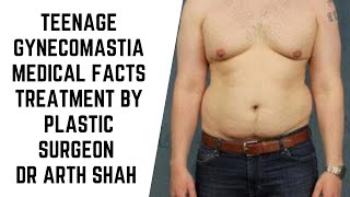 Teenage Gynecomastia Medical facts and Treatment options explained by Plastic Surgeon Dr Arth Shah