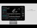 TEX20 Demo Series - Smart IVC