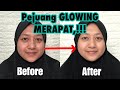 GLOWING DALAM 2minggu 😱,!! Review skincare Reglow by dr. Shindy Putri | Irma Melati