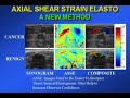 Tissue Elasticity Evaluation – Elastography