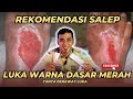 Rekomendasi Salep Untuk Luka Warna Dasar Merah❗️