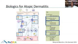 Webinar Part 1 - Emerging Therapies for Moderate-to-Severe Atopic Dermatitis in Children