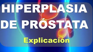 Por qué se produce la Hiperplasia Prostática Benigna?. Explicación