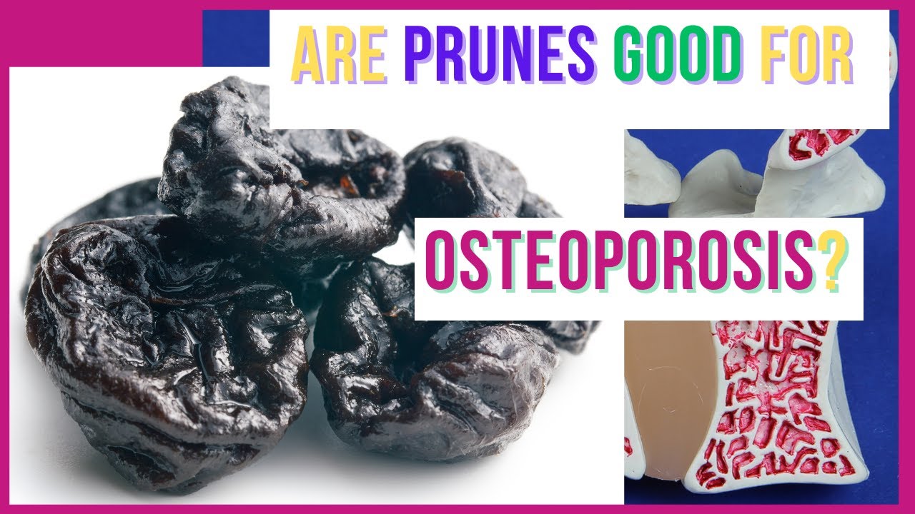 Are Prunes Good For Osteoporosis? - YouTube