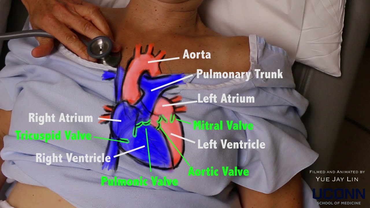 Heart Auscultation - YouTube