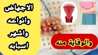 #رحلةالحمل اكثر اسباب الاجهاض والوقاية منه