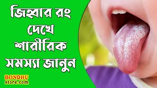 জিহ্বার রং দেখে শারীরিক সমস্যা জানুন । WHAT DOES YOUR TONGUE SAY ABOUT YOUR HEALT । BondhuStore