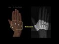 anatomy of hand x rays_revised