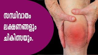 സന്ധിവാതം ലക്ഷണങ്ങളും ചികിത്സയും # Arthritis treatment # Arogyavicharam | Tv Live Asia