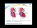 congestive heart failure february 2015 webinar