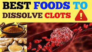 How to Avoid Blood Clots | Ginger as Blood Thinners | Natural Blood Thinners | Hilly herbs |