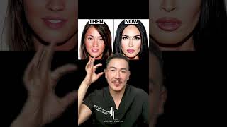 Megan Fox Plastic Surgery Analysis