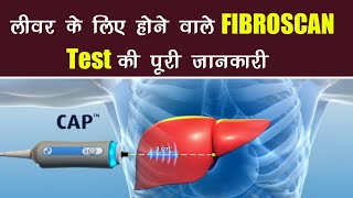 fibroscan liver | fibroscan , test ,price ,score ,results , in hindi | fibroscan test kaise hota hai