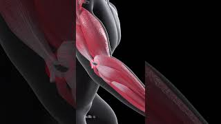 What Is Tennis Elbow (Animation)