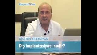 Diş implantasiyası nədir?