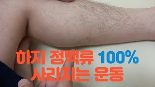 하지 정맥류 운동 100%효과 보는 운동법