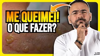 QUEIMADURA EM CASA! APRENDA O QUE FAZER NOS PRIMEIROS INSTANTES