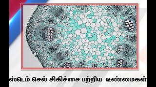 ஸ்டெம் செல் சிகிச்சை பற்றிய  உண்மைகள்|sathiyam tv