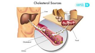 İyi Kolesterol  ve  Kötü Kolesterol Nedir?