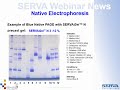 SERVA Webinar: Native Electrophoresis (English)