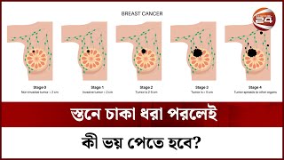 স্তনে চাকা ধরা পরলেই কী ভয় পেতে হবে? || Breast Cancer || Breast Lump || Channel 24