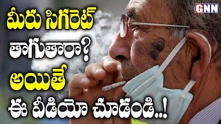 మీరు సిగరెట్ తాగుతారా? ఈ వీడియో మీకోసమే | Rethink About your Smoking Habits | GNN TV Telugu