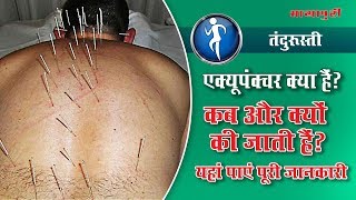 Acupuncture क्या होता है? कैसे काम करता है? Health Tips