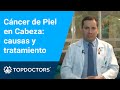 Cáncer de Piel en Cabeza: causas y tratamiento