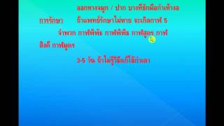 ไข้หวัด,ไข้กำเดา,ไข้คดไข้แหงน