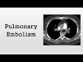 Pulmonary Embolism