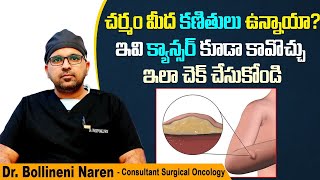 చర్మం మీద క్యాన్సర్ గడ్డలు | Soft Tissue Sarcoma in Telugu | Cancer Tumor | Kaizen Oncology Network